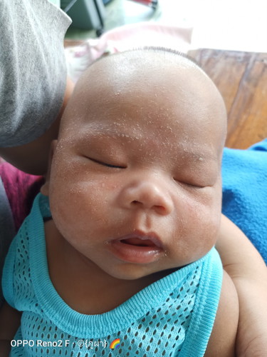 ผิ่นหรืออะไรคะ