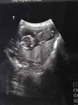 13+1 ตัวเล็กมั้ยครับ