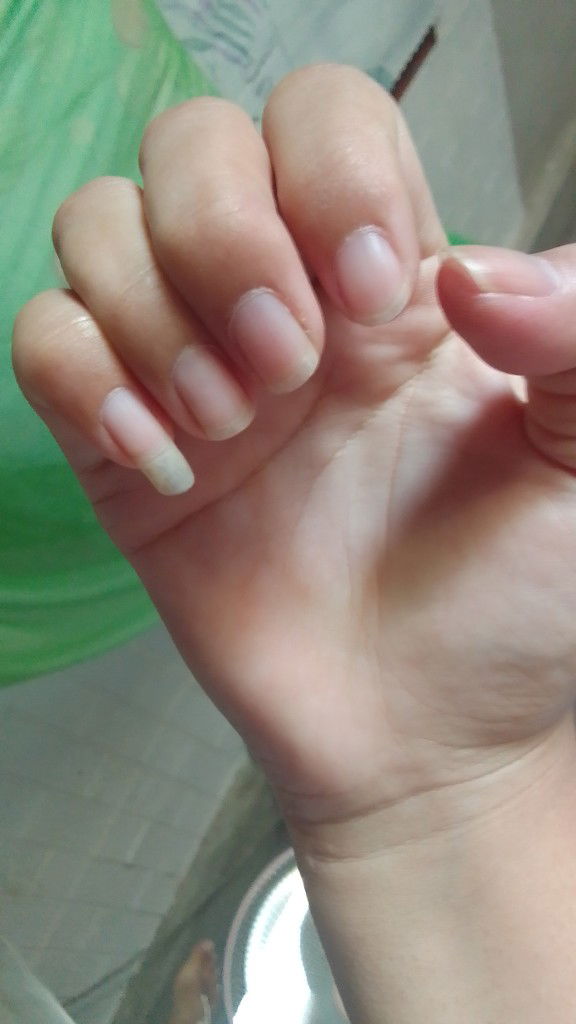 เล็บยาวหมอดุมั้ย