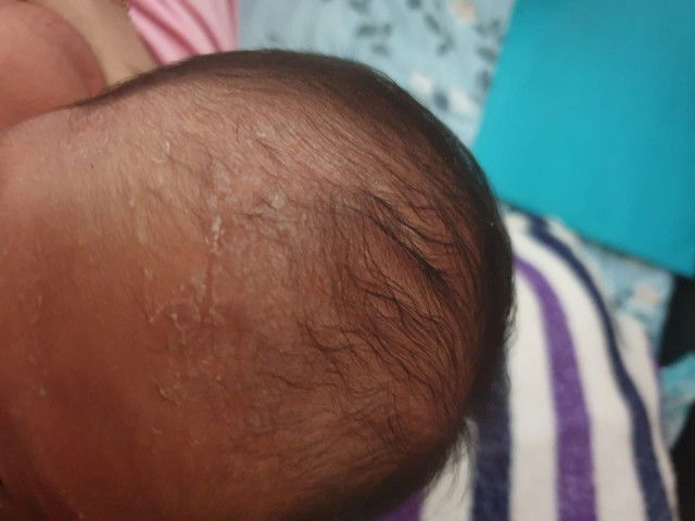 masalah baby newborn