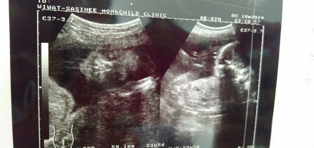 ลูกสาวอีกแล้ว