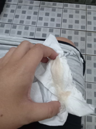 37วีค2วัน เริ่มมีอาการแบบนี้