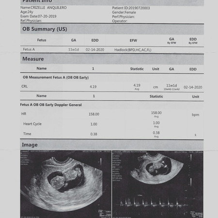 ULTRASOUND FOR GENDER