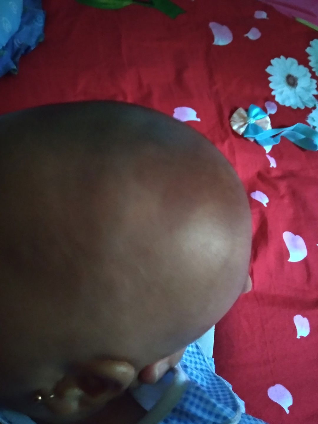 merah dikepala obatnya apa