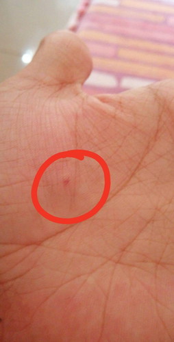 Nasugatan Ako Ng Aso Namin.. Worried Pls Help