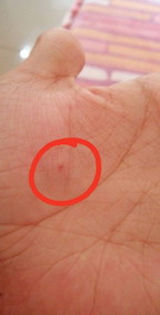 May Rabbies Ba Ang Kuko Ng Aso?