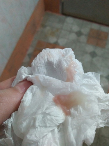 โดนกระตุ้น