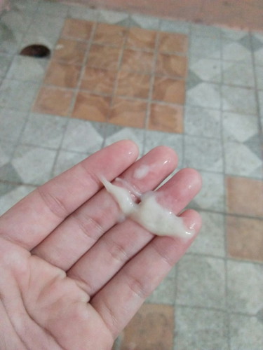 มูกสีขาวขุ่น