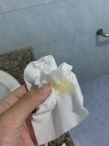 มูกเหนียว