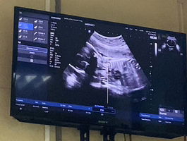 Pimmeee profile icon