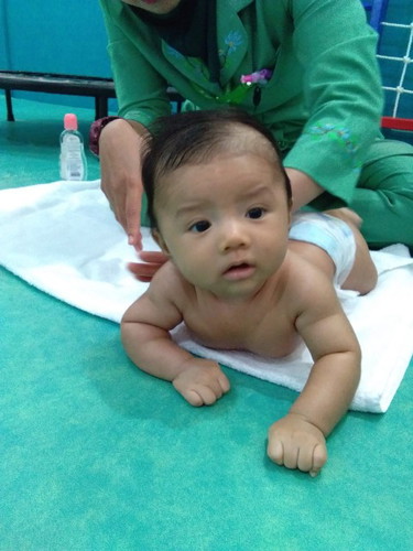 rambut rontok