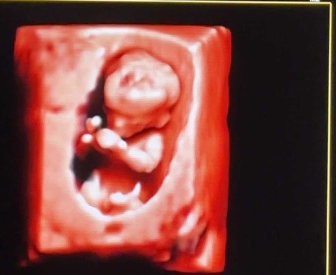 แม่ๆซาวด์4มิติ มองเห็นเพศชัดตอนกี่วีค