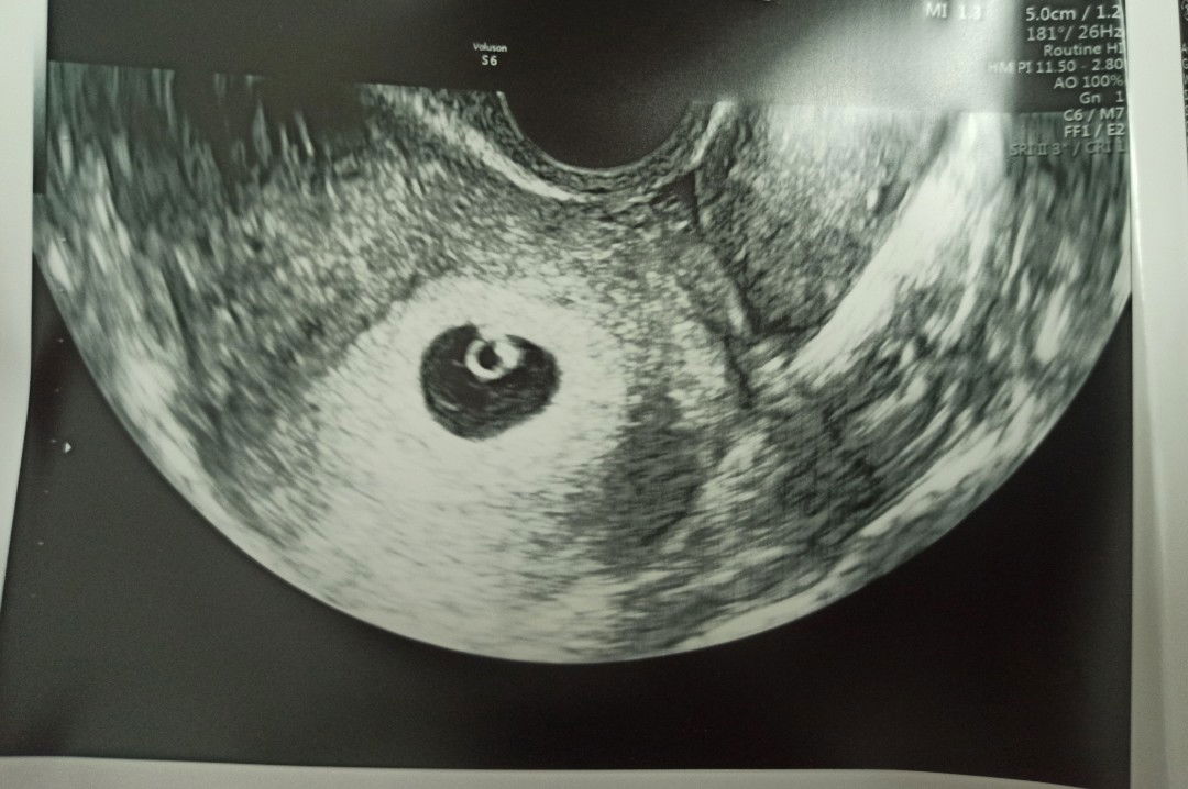 แชร์ประสบการณ์เพศลูกกันค่ะ