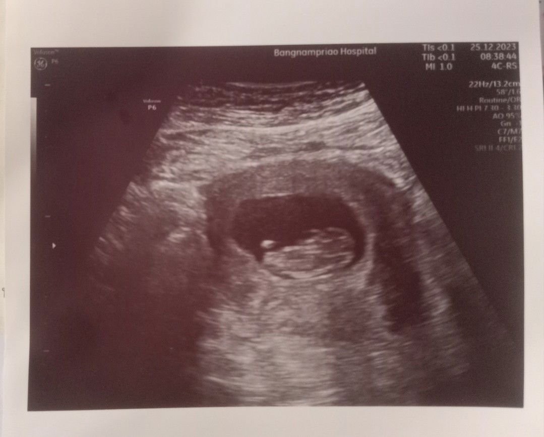 ณภัทรประภา ห่วงพิมล profile icon