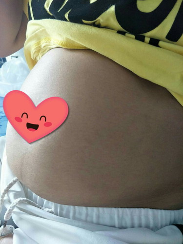 20 W ท้องใหญ่มากกอึดอัดสุด ?