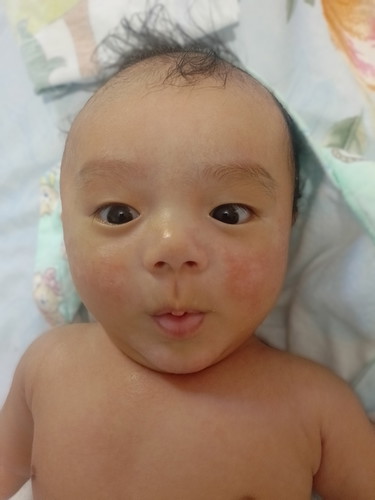 Ano po kaya ang mabisang gamot sa face ni baby? 🥺