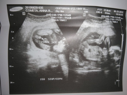 its a baby boy