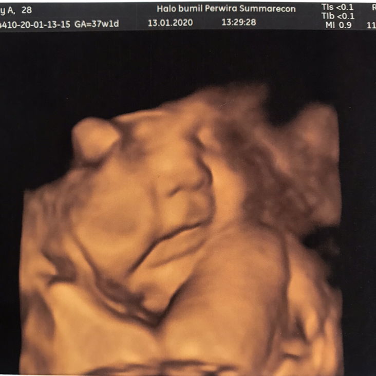 37week berat bayi 3,1 kg