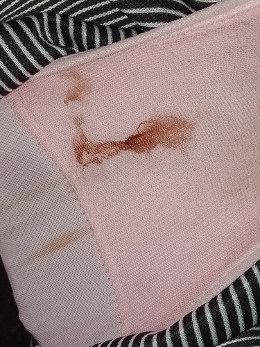 แบบนี้คืออะไร