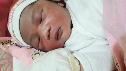 Vaginal Birth After 2 Cesarean.