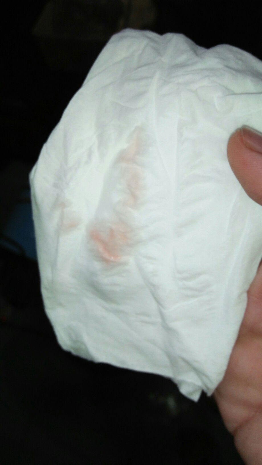 สอบถามหน่อยค่ะ 32+2 วีค มีใครเคยเป็นแบบนี้มั้ยค่ะ