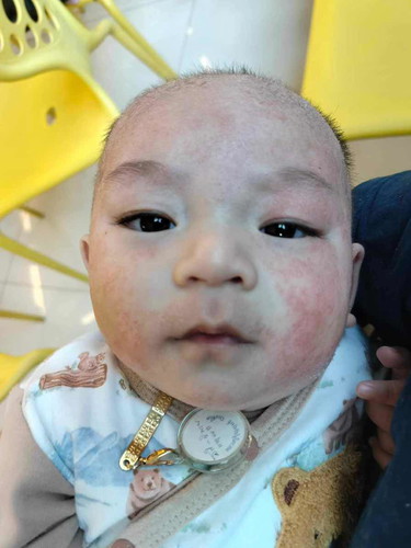 ลูกแพ้นมวัวทำยังไงดี