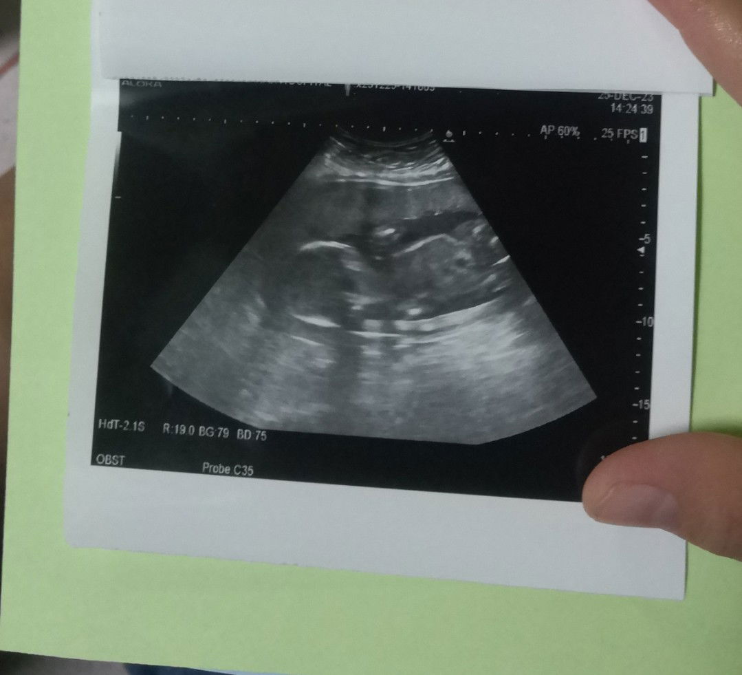 น.ส สุภาวัณ์ ชัยอุดม profile icon