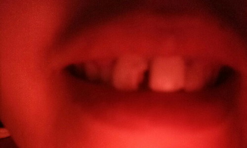 teeth