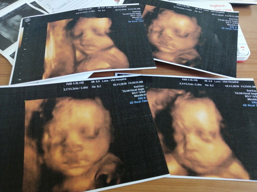 How To Be Good Single Mom's