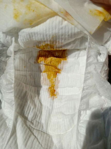 ลูกอึมีมูกเลือดออกมาด้วย