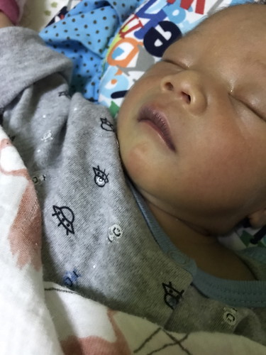 Bibir bayi baru lahir
