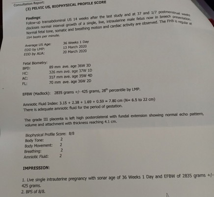 breech position at 37 weeks
