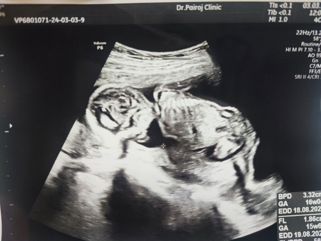 Prasertsang profile icon