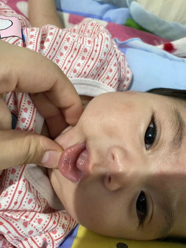 ลูกปากม่วงเเบบนี้อันตรายไหมคะกังวลมาก