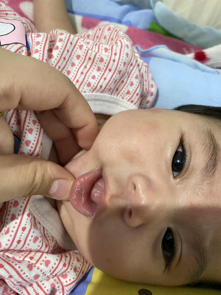 ขอคำเเนะนำหน่อยค่ะ