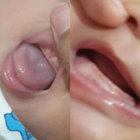 teething na po ba?