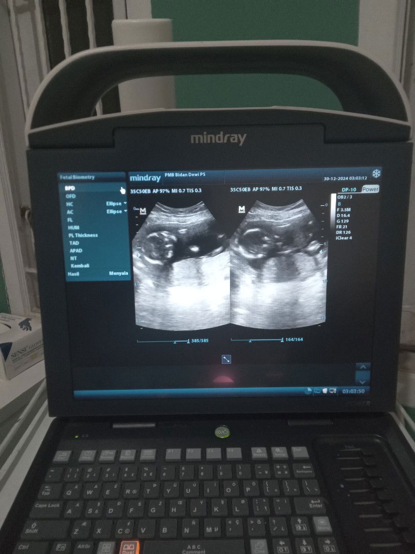 Hallo bunda2 cantikk.. Semoga sehat selalu diakhir tahun ini..