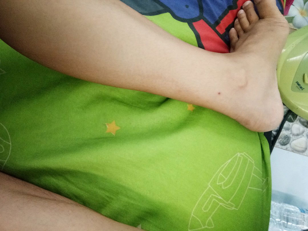 แม่บ้านไหนมีอาการปวดเกร็งกล้ามเนื้อมั้ยคะ อันตรายไหม