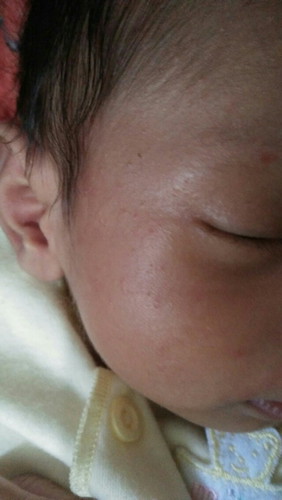 Bintik Bayi Satu Bulan