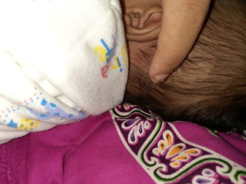 benjoln di belkang kepla bayi