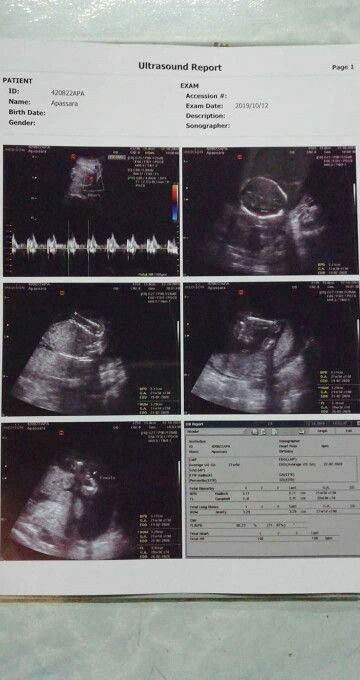 Apassara Amara profile icon