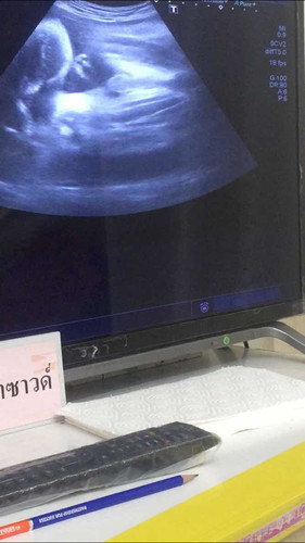 ใครเดาได้บ้างว่าเพศอะไร(เห็นชัดเจนมาก) ??