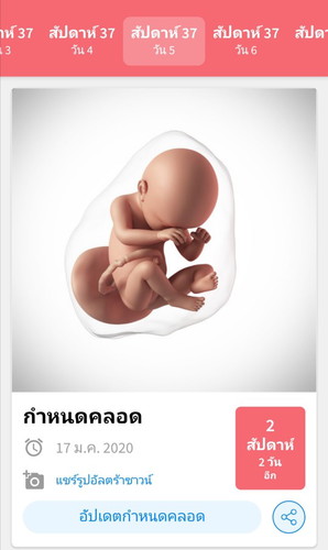 ถามอาการแม่ๆหน่อยคะ