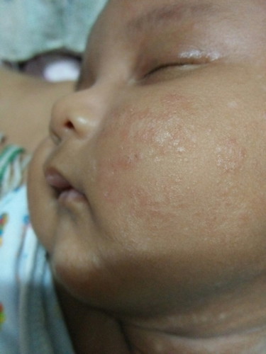 เม็ดอะไร