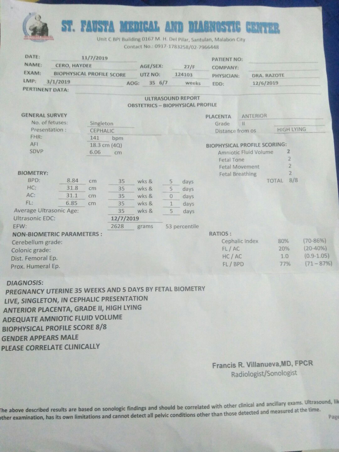 FROM breech to Cephalic