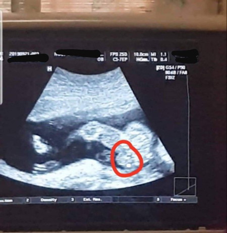 Is my baby a boy or a girl? ?