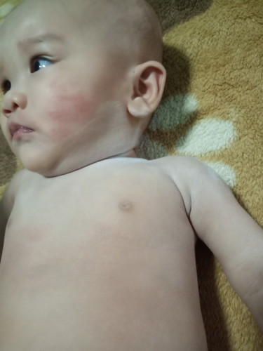 แก้มน้องแดง