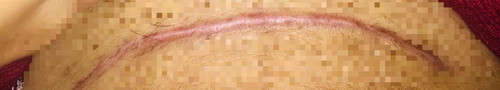 Luka sc