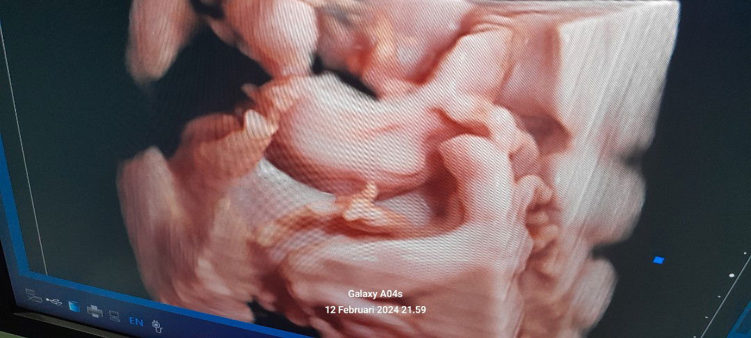 نعم نينا ميهيسا يونينجسيه profile icon