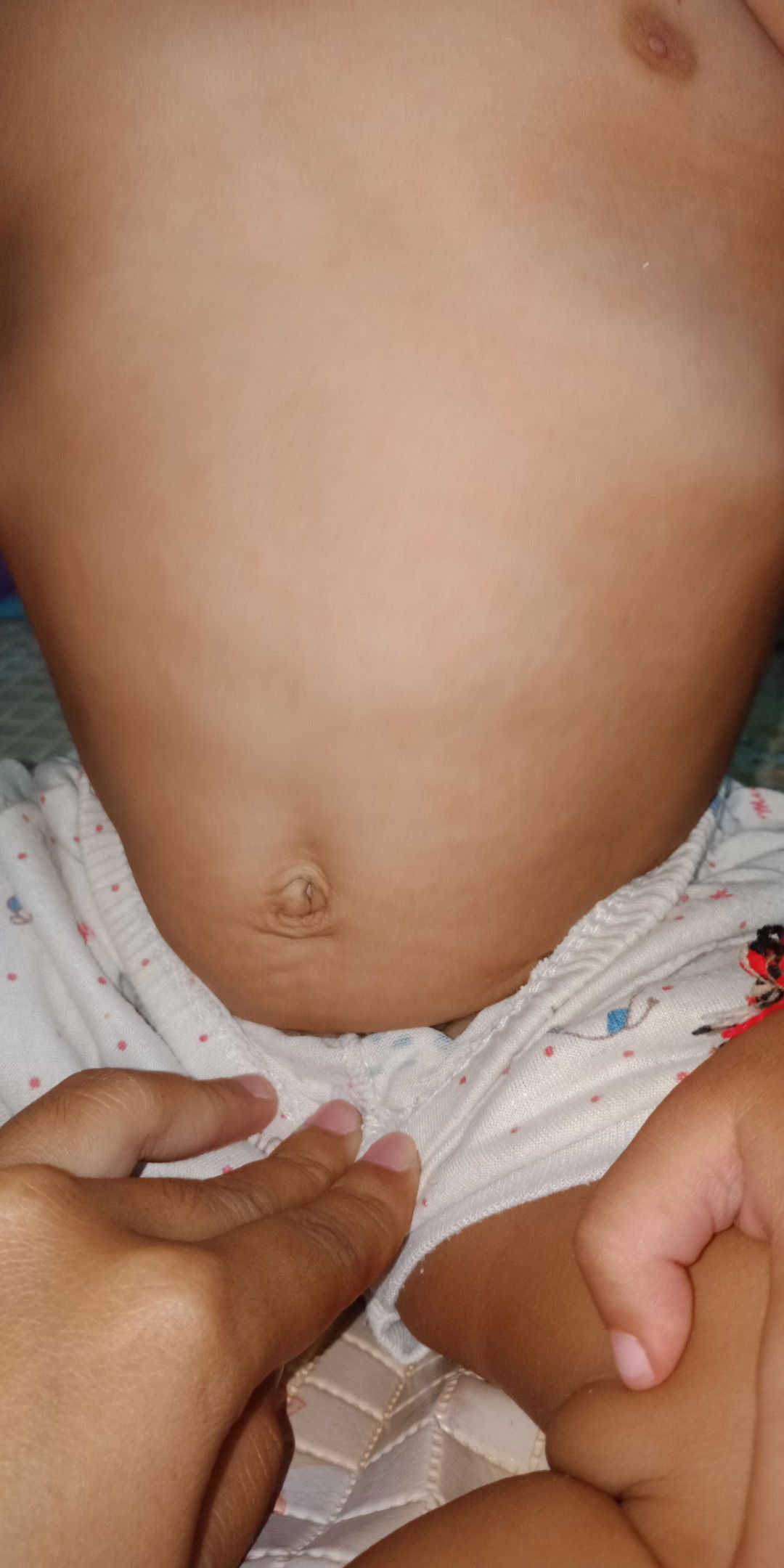 campak istilah jawanya gabak